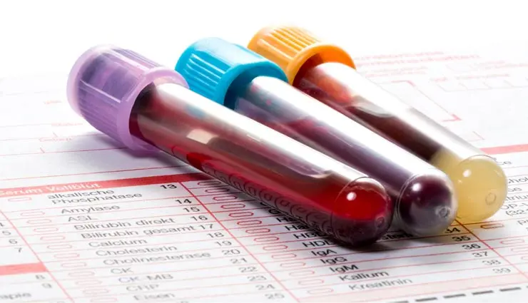 چکاپ در منزل