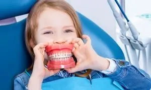 ارتودنسی کودکان در اصفهان؛ سن مناسب و مراحل درمان