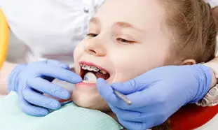 شروع زودهنگام و یا دیرهنگام ارتودنسی؛ کدام برای لبخند کودک بهتر است؟