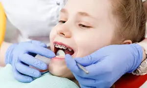 شروع زودهنگام و یا دیرهنگام ارتودنسی؛ کدام برای لبخند کودک بهتر است؟