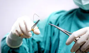 اهمیت نخ‌ های جراحی باکیفیت در کاهش خطای جراحی