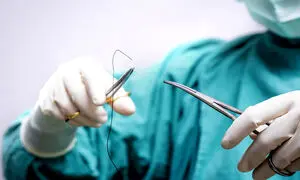 اهمیت نخ‌ های جراحی باکیفیت در کاهش خطای جراحی