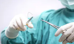 اهمیت نخ‌ های جراحی باکیفیت در کاهش خطای جراحی