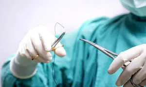 اهمیت نخ‌ های جراحی باکیفیت در کاهش خطای جراحی