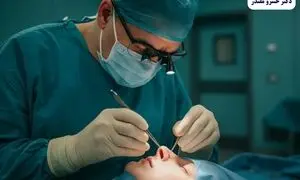 تحول بینی گوشتی: رازهای پنهان زیبایی که هرگز نمی‌دانستید
