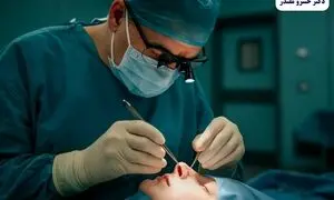 تحول بینی گوشتی: رازهای پنهان زیبایی که هرگز نمی‌دانستید
