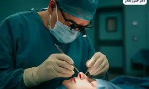 تحول بینی گوشتی: رازهای پنهان زیبایی که هرگز نمی‌دانستید