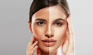چگونه پوست سفید داشته باشیم؟(راهکارهای طلایی ساده)