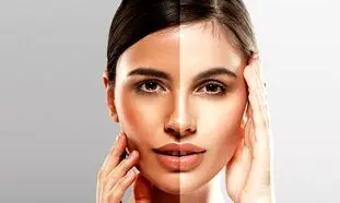 چگونه پوست سفید داشته باشیم؟(راهکارهای طلایی ساده)