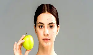 ۵ ماده غذایی مضر که باعث ایجاد جوش و آکنه می‌شود