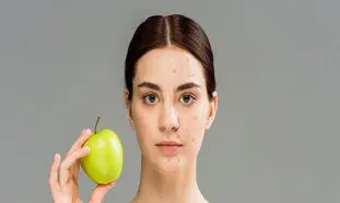 ۵ ماده غذایی مضر که باعث ایجاد جوش و آکنه می‌شود