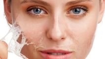 پرفروش ترین کرم لایه بردار ایرانی برای شفافیت پوست
