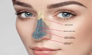 مزایای جراحی طبیعی بینی استخوانی چیست؟