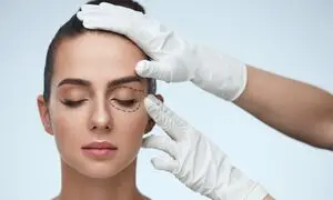 آیا جراحی پلک برگشت دارد؟