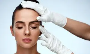 آیا جراحی پلک برگشت دارد؟