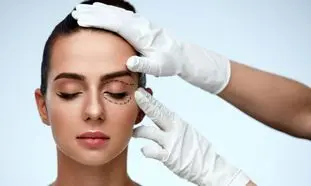 آیا جراحی پلک برگشت دارد؟