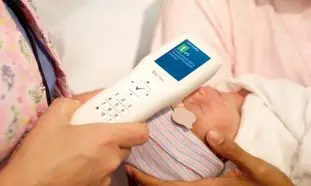 تشخیص زردی نوزاد با بیلی روبین چک