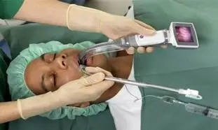 ویدیو لارنگوسکوپ چیست و چه کاربردی دارد؟