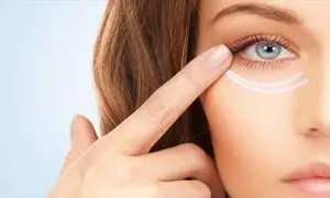 پرفروش ترین کرم دورچشم ضدتیرگی + قیمت