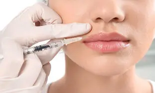 تزریق ژل لب و همه چیز درباره آن