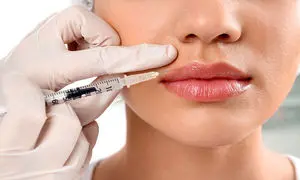 تزریق ژل لب و همه چیز درباره آن