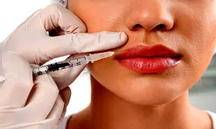 تزریق ژل لب و همه چیز درباره آن
