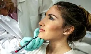 زاویه سازی فک چه تاثیری در زیبایی چهره دارد؟