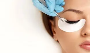 کاشت مژه و توصیه‌های کلیدی که باید بدانید