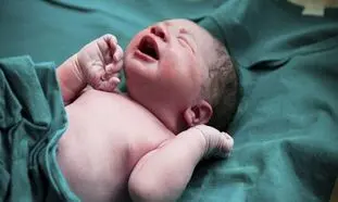 تولد نوزادی با چهار دست و پا در هند + تصویر
