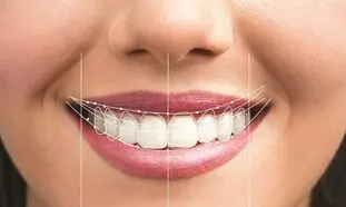 چطور یک لبخند زیبا داشته باشیم؟