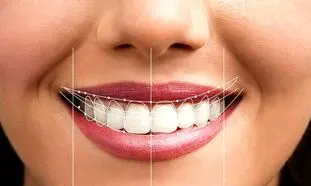 چطور یک لبخند زیبا داشته باشیم؟