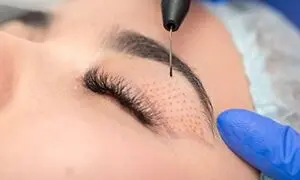 زیبایی چهره ی خود را به پزشکان حرفه ای کلینیک الیزه لانژه بسپارید