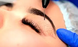 زیبایی چهره ی خود را به پزشکان حرفه ای کلینیک الیزه لانژه بسپارید