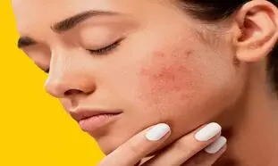 داشتن پوستی یکدست و صاف با کرم پودر رویال اترنیتی