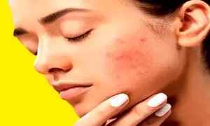 داشتن پوستی یکدست و صاف با کرم پودر رویال اترنیتی