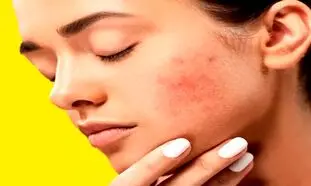 داشتن پوستی یکدست و صاف با کرم پودر رویال اترنیتی