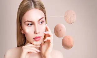 نحوه از بین بردن لک های صورت + معرفی بهترین محصولات ضد لک