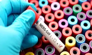 هر آنچه باید درباره ویروس MERS-COV بدانید