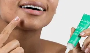 پرفروش ترین کرم ضدجوش صورت + قیمت