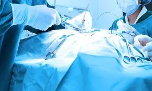 چند نکته کلیدی هنگام خرید شان جراحی