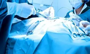 چند نکته کلیدی هنگام خرید شان جراحی