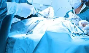 چند نکته کلیدی هنگام خرید شان جراحی