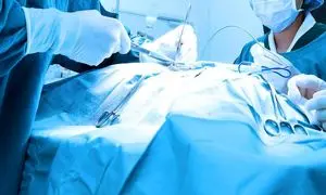 چند نکته کلیدی هنگام خرید شان جراحی