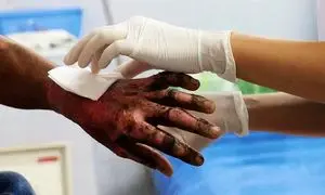 سوختن ۶ نوجوان بر اثر خلاقیت شهرداری تهران