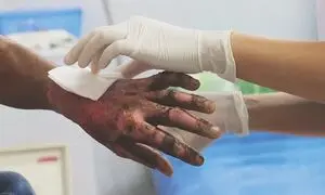 سوختن ۶ نوجوان بر اثر خلاقیت شهرداری تهران