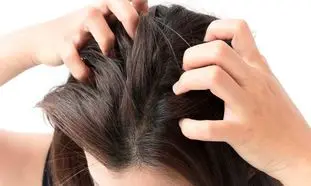 علت خشکی پوست سر زنان چیست + درمان خانگی