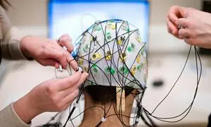 نقش دستگاه EEG در تشخیص اختلالات روانی