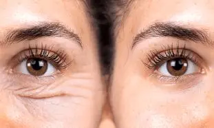 پرفروش ترین کرم ضد چروک صورت در بازار + قیمت