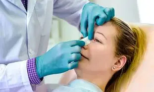 شرایط اقساطی عمل بینی در تهران