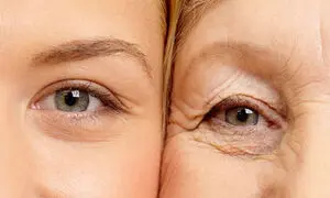 بهترین کرم دور چشم برای جوانسازی + قیمت